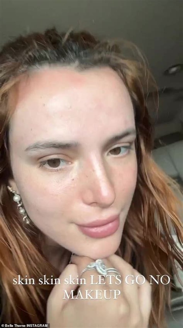 Bella Thorne suffers with acne: ‘You go out and people think you’re dirty’