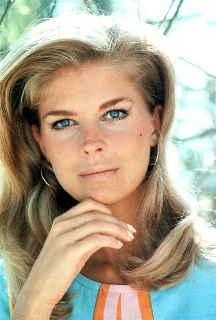 	Candice Bergen fainted while getting injections at the dermatologist	