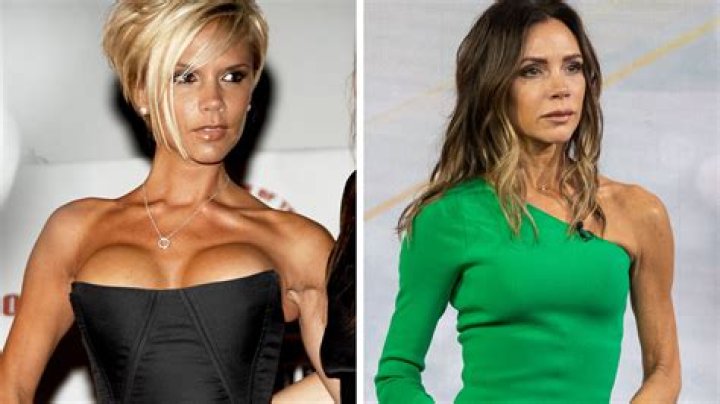 Did Rihanna & Kate Bosworth get breast implants?