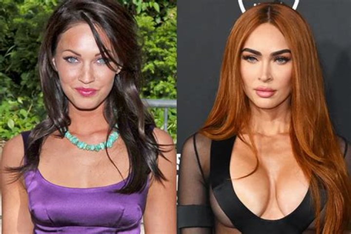Has Megan Fox really spent $60,000 on plastic surgery?