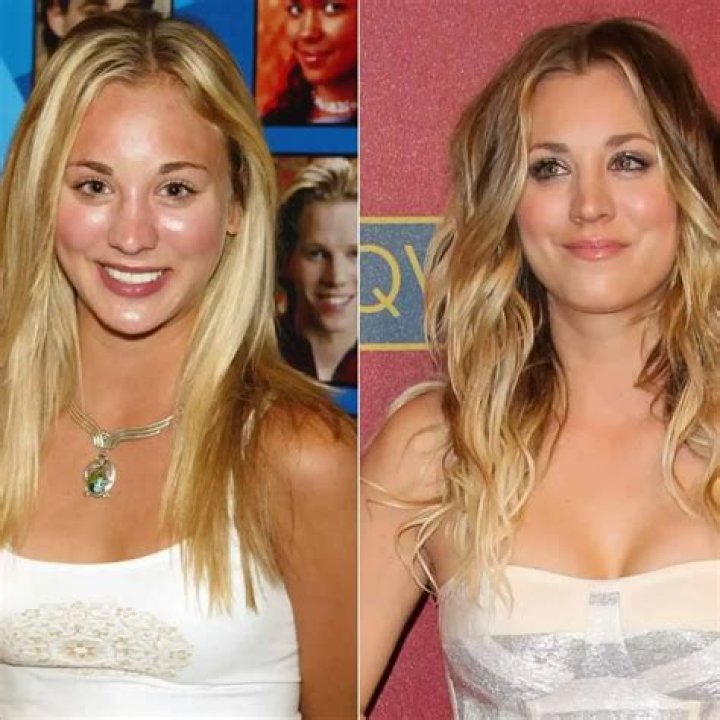 Kaley Cuoco got breast implants at 18, says it was ‘the best decision I ever made’
