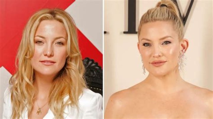 Kate Hudson on plastic surgery: ‘Will everybody stop being so judgmental?’
