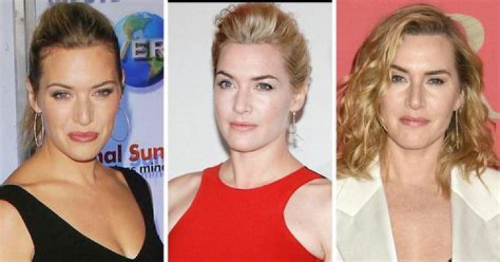 Kate Winslet’s face in Venice: jacked, tweaked and made of lies?