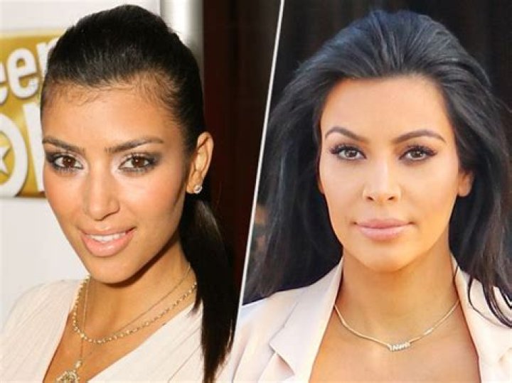 Kim Kardashian: ‘I also lasered my neck because I had such a hairy neck’