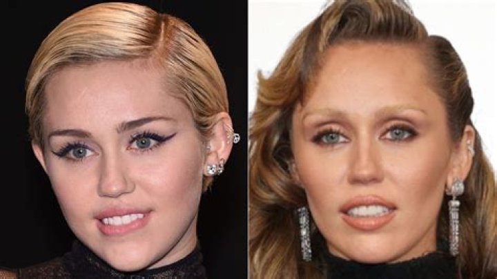 Miley Cyrus dramatically changed her hair color & maybe got buccal fat removal?