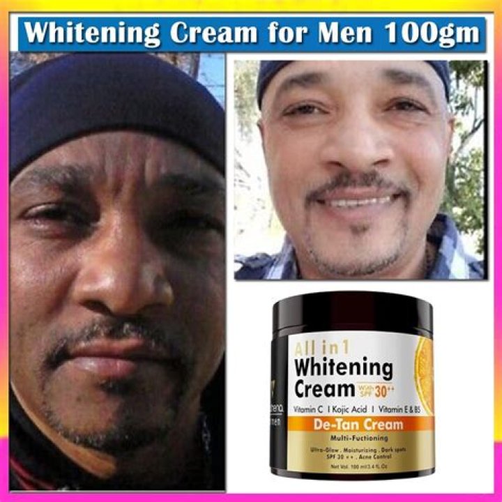 Rx skin bleaching cream among Michael Jackson’s effects on eBay